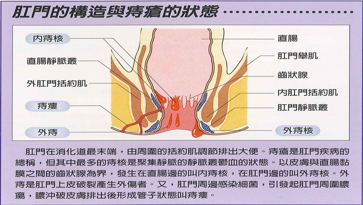 肛周静脉窦图片